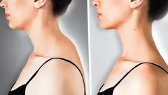 Nejlepší cviky na odstranění hrbu u krku a pro pevná ramena